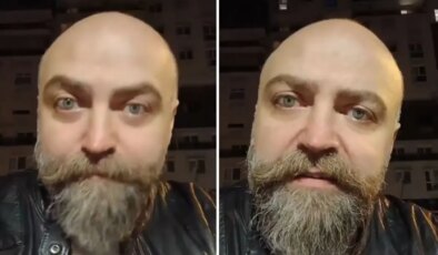 Saçsız adam isyan etti! Berbere ödediği ücret öyle böyle değil